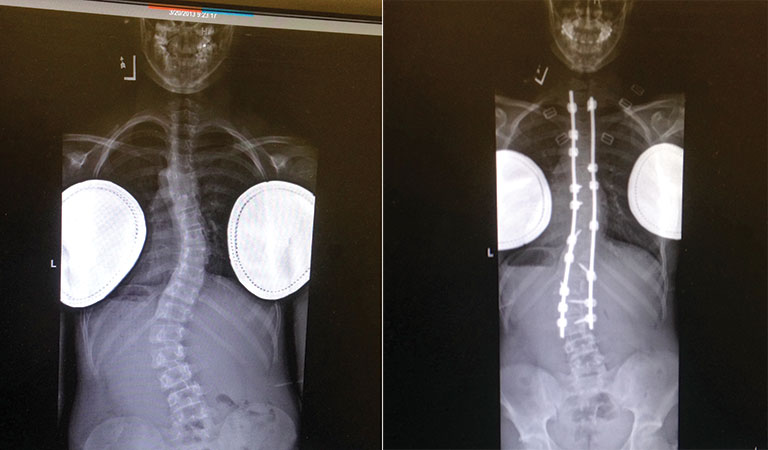 a set of x-rays