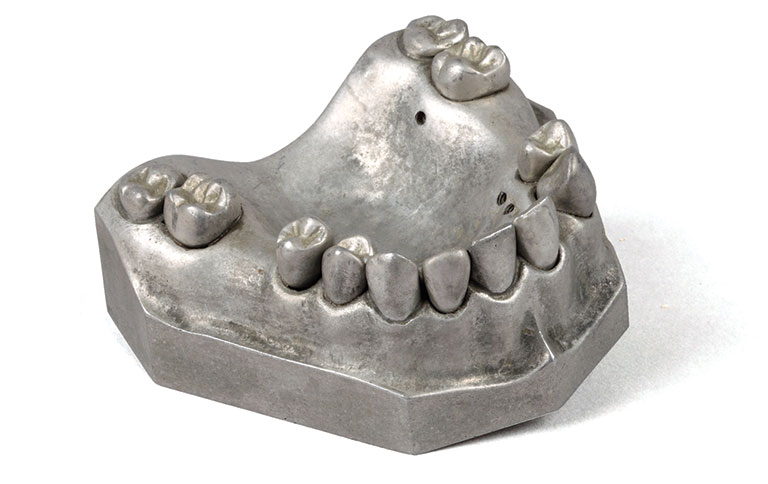A silver denture mold.